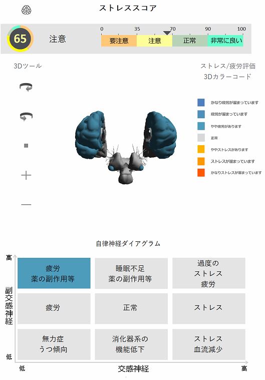 ストレススコア